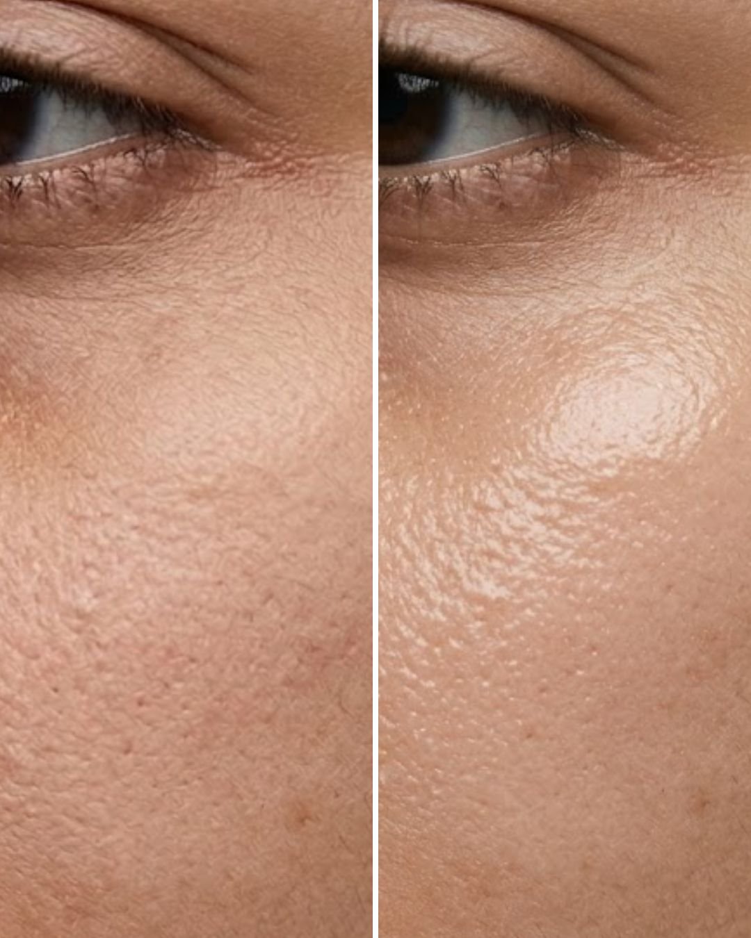 Facials (Hydra/ Glow)
